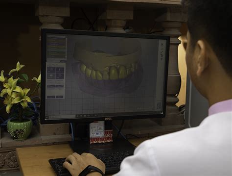 dental implants cost in cambodia|Price List – Dental Clinic.